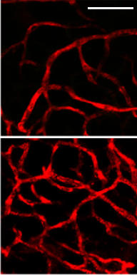 Mikroskopický snímek angiogeneze v tukové tkáni působením nanočástic, nahoře původní, dole po jejich působení. Bílá úsečka je 50 mikrometrů dlouhá (podle Y.Xue et al., Preventing diet-induced obesity in mice by adipose tissue transformation and angiogenesis using targeted nanoparticles, PNAS May 2, 2016, doi: 10.1073/pnas.1603840113).