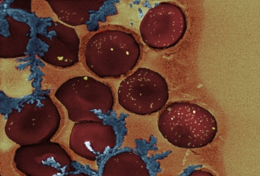 Zlaté nanotyčinky vidíme jako žluté tečky na povrchu červených krvinek. Foto Helena de Puig.