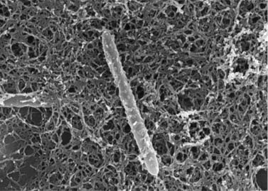 Tyčinkovitá, 4 mikrometry dlouhá bakterie D.audaxviator z dole Mponeng (foto Greg Wanger, J. Craig Venter Institute, a Gordon Southam, University of Western Ontario)