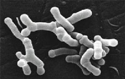 Snímek bakterií Bifidobacterium longum pořízený elektronovým mikroskopem, obr. Julie6301, CC BY-SA 3.0, https://creativecommons.org/licenses/by-sa/3.0/deed.en, via Wikimedia Commons.