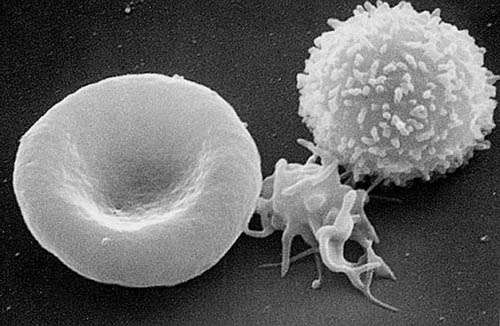 Základní krevní buňky na snímku elektronového mikroskopu. Červená krvinka (erythrocyt) leží úplně vlevo, uprostřed krevní destička a vpravo bílá krvinka neboli leukocyt (foto National Cancer Institute v Fredericku, USA, veřejná doména).