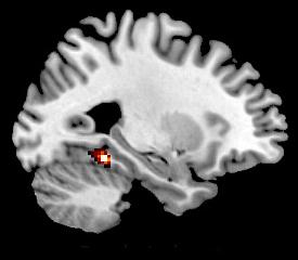Nevelká oblast mozku studovaná prof.Gabrielim je vyznačena červeně pod velkou černou skvrnou (mozková komora) uprostřed obrázku (foto Julie Yoo).