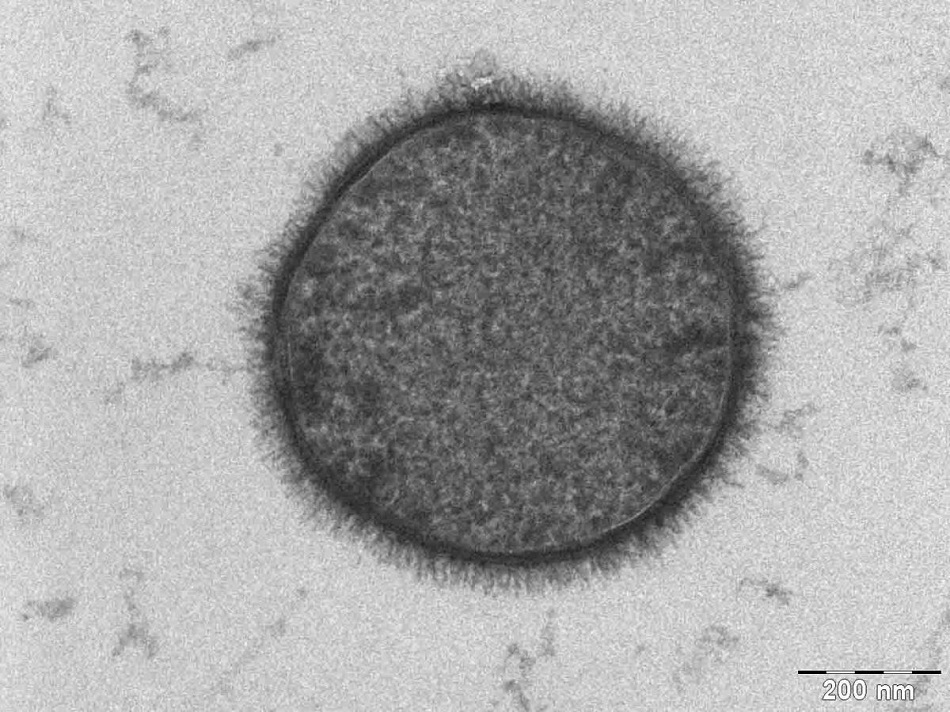 Mikroskopický snímek bacila senného (Bacillus subtilis), foto Allonweiner at English Wikipedia [Public domain], via Wikimedia Commons.