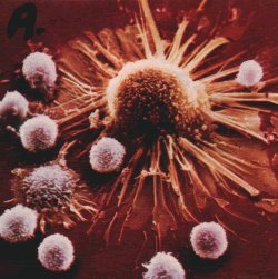 Imunitní buňky CD8 T napadají rakovinou buňku (foto Northern Arizona University)