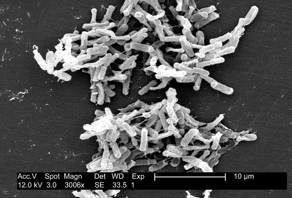 Bakterie Clostridium difficile na snímku elektronového mikroskopu, volné dílo via Wikimedia Commons.
