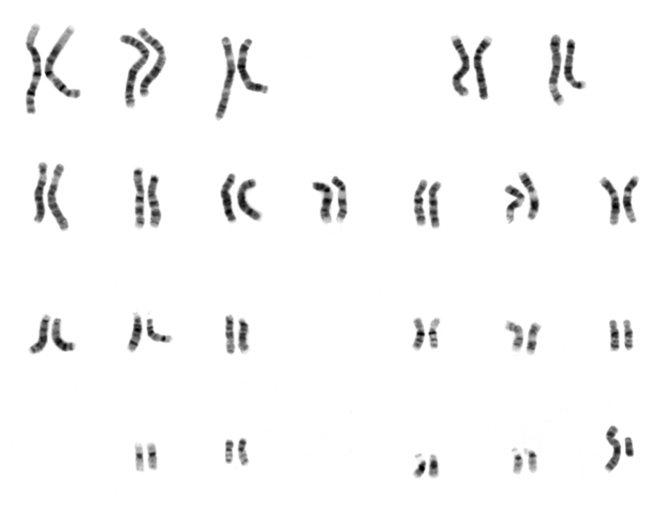 Mikroskopický snímek obarvených mužských chromozomů (National Human Genome Research Institute, Public domain, via Wikimedia Commons).