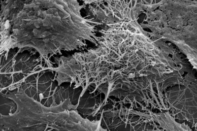 Vlákénka na povrchu buňky ve středu obrázku představují jednotlivé viriony viru Ebola. Snímek byl pořízen rastrovacím elektronovým mikroskopem. Foto Paul Bates, University of Pennsylvania School of Medicine.