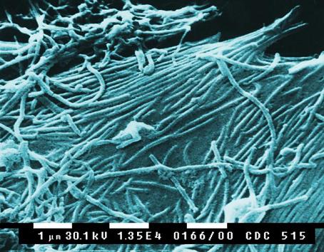 Jednotlivá vlákénka představují viriony Eboly. Snímek byl pořízen rastrovacím elektronovým mikroskopem (foto PLoS Biol 3/11/2005).