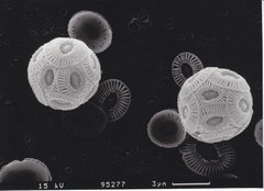 Snímek řas Emiliania huxleyi pořízený elektronovým mikroskopem. Průměr buňky je asi 5 mikrometrů a na jejím povrchu zřetelně vidíme vápenité šupinky - kokolity. Foto: Lennart Bach, GEOMAR