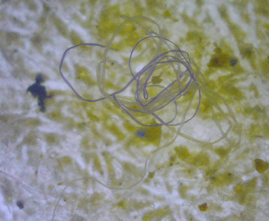 Vláknitý mikroplast v moři, foto M.Danny25 [CC BY-SA 4.0 (https://creativecommons.org/licenses/by-sa/4.0)].