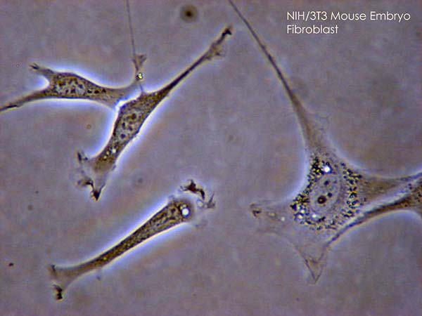 Mikroskopický snímek fibroblastů myšího embrya, (foto SubtleGuest (slika uzeta sa engl. vikipedije, CC-BY-SA-3.0, http://creativecommons.org/licenses/by-sa/3.0/, via Wikimedia Commons).