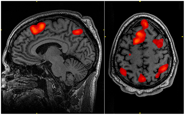 fMRI zobrazení lidského mozku při studiu paměti, obr.John Graner, Walter Reed National Military Medical Center