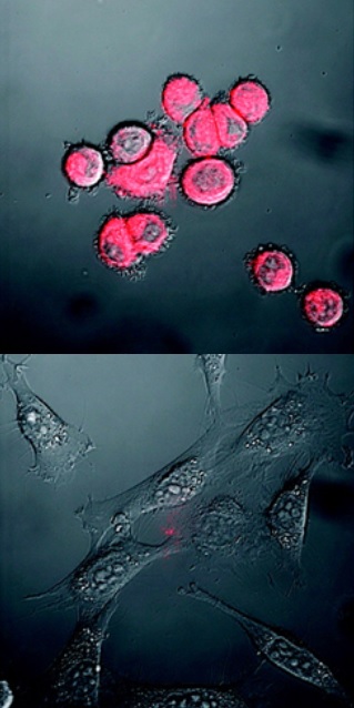 Nahoře svítící rakovinné buňky, dole normální buňky na mikroskopickém snímku (foto International Institute for Nanotechnology, Northwestern University).