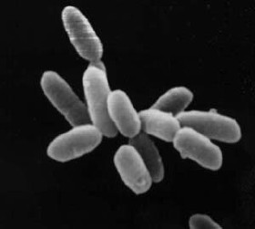 Halobacterie, často studovaný archeon na snímku elektronového mikroskopu. Délka buňky je 5 mikrometrů, foto NASA, public domain.