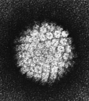 Snímek virionu HPV pořízený elektronovým mikroskopem (NIH-Visuals Online# AV-8610-3067).