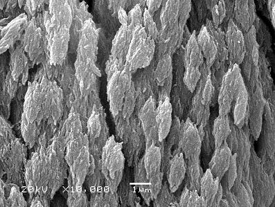 Snímek lebeční kosti potkana pořízený elektronovým mikroskopem po odstranění bílkovinného kolagenu. Vidíme jednotlivé krystalky hydroxylapatitu. Citrát na jejich povrchu zabraňuje dalšímu růstu.
