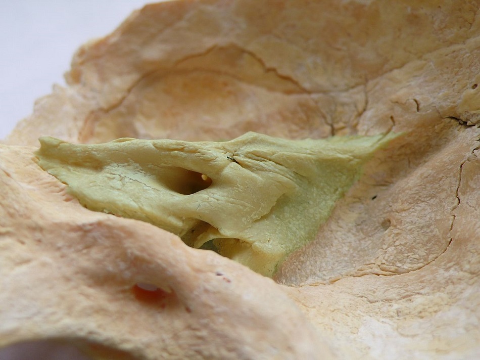 Lidská kost skalní (zelená) jako součást spánkové kosti. (Autor: Welleschik – Vlastní dílo, CC BY-SA 3.0, https://commons.wikimedia.org/w/index.php?curid=6995289).