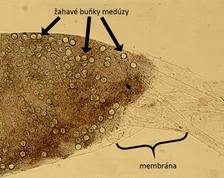 Mikroskopický detail langustí stolice. Žahavé buňky a ochranná membárna jsou dobře patrné (foto Kaori Wakabayashi/Plankton and Benthos Research.