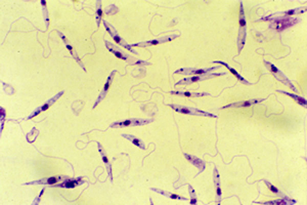Mikroskopický snímek prvoků Leishmania (foto F.Grimm, Curyšská univerzita)