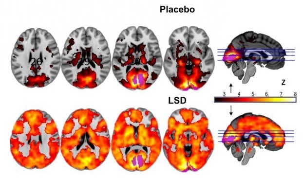 Nárůst aktivity mozku vlivem LSD (Imperial College London: Brain on LSD revealed: First scans show how the drug affects the brain, ScienceDaily, 11 April 2016, www.sciencedaily.com/releases/2016/04/160411153006.htm).