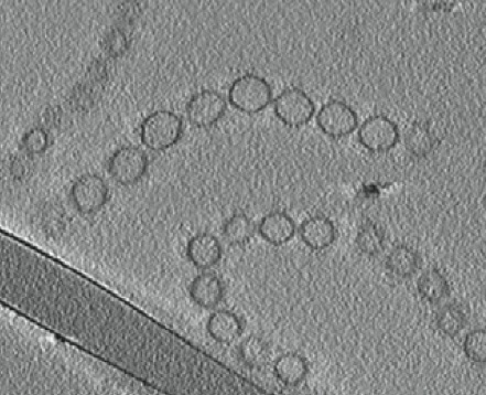Snímek řezu spojovacích můstků bakterií pořízený transmisním elektronovým mikroskopem (foto laboratoř Manfreda Auera/ Lawrence Berkeley National Laboratory).