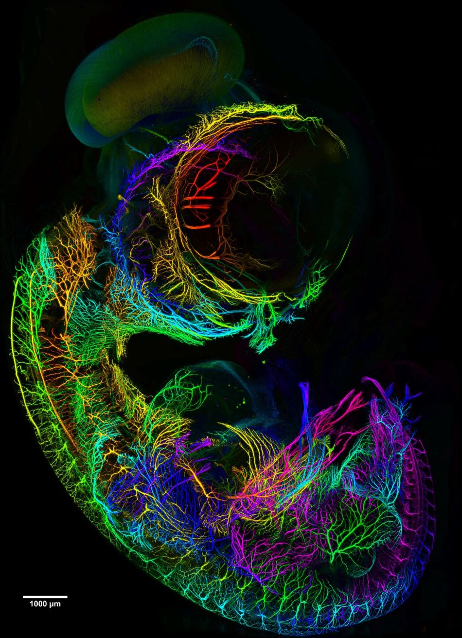 Zobrazení mozku sedmidenního kuřecího embrya mikroskopem mesoSPIM, obr. mesospim.org.