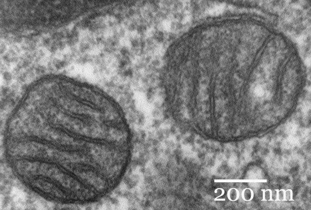 Mitochondrie z buněk savčích plic na snímku transmisního elektronového mikroskopu, foto Louisa Howard [Public domain].