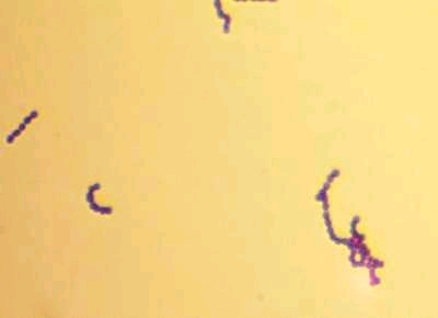 1000 x zvětšený Enterococcus faecalis