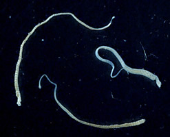 Tři jedinci tasemnice dětské (Rodentolepis nana) dlouzí 15 až 40 mm (foto Georgia Division of Public Health).