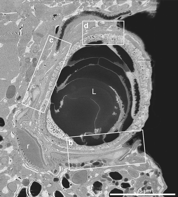 Řez ocelloidem na snímku z elektronového mikroskopu (Eye-like ocelloids are built from different endosymbiotically acquired components, Gregory S. Gavelis et al.,  Nature, 523, 204–207 (09 July 2015), doi:10.1038/nature14593), písmeno L označuje čočku, r komponentu fungující jako sítnice.