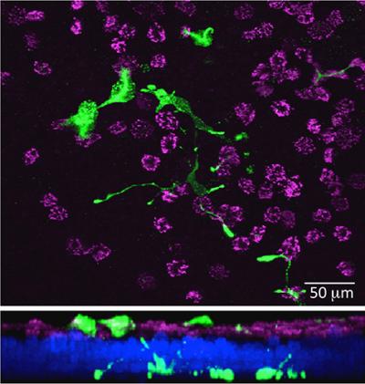Mikroskopický snímek plicní tkáně od Yehudy Ben-Sharara. Zelené jsou lahvovité neuroendokrinní buňky, fialové jsou běžné buňky plicního epitelu. V dolní části je řez plicní tkání.