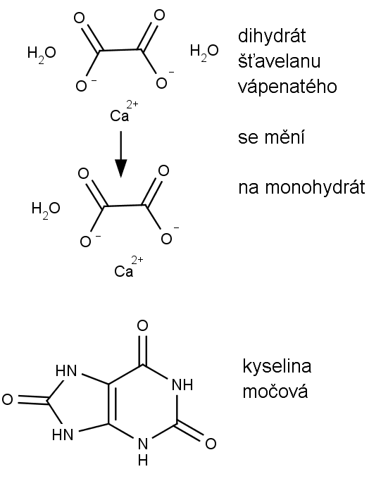 Chemická struktura hydratovaného šťavelanu vápenatého a kyseliny močové (dole).