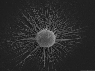 Snímek buňky kvasinky Cryptococcus neoformans pořízený rastrovacím elektronovým mikroskopem. Zřetelně můžeme vidět polysacharidové řetězce, které ji obklopují (Foto Albert Einstein College of Medicine).