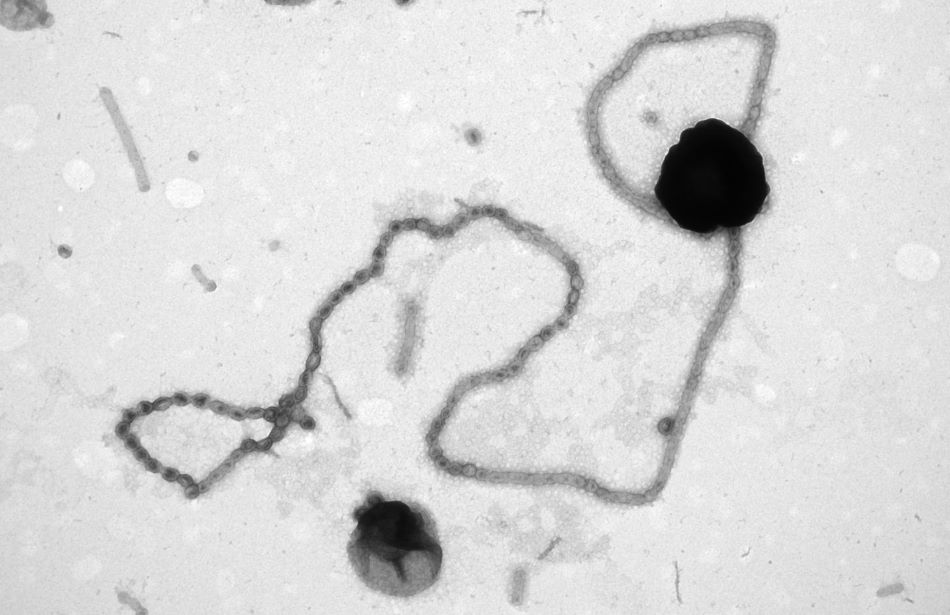 Snímek perličkující flavobacterie pořízený elektronovým mikroskopem, foto Max Planck Institute for Marine Microbiology/Tanja Fischer.