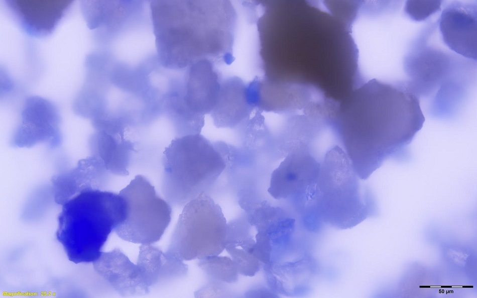 Zvětšená zrníčka pigmentu lapis lazuli v mineralizovaném zubním plaku zesnulé řeholnice, foto Monica Tromp.