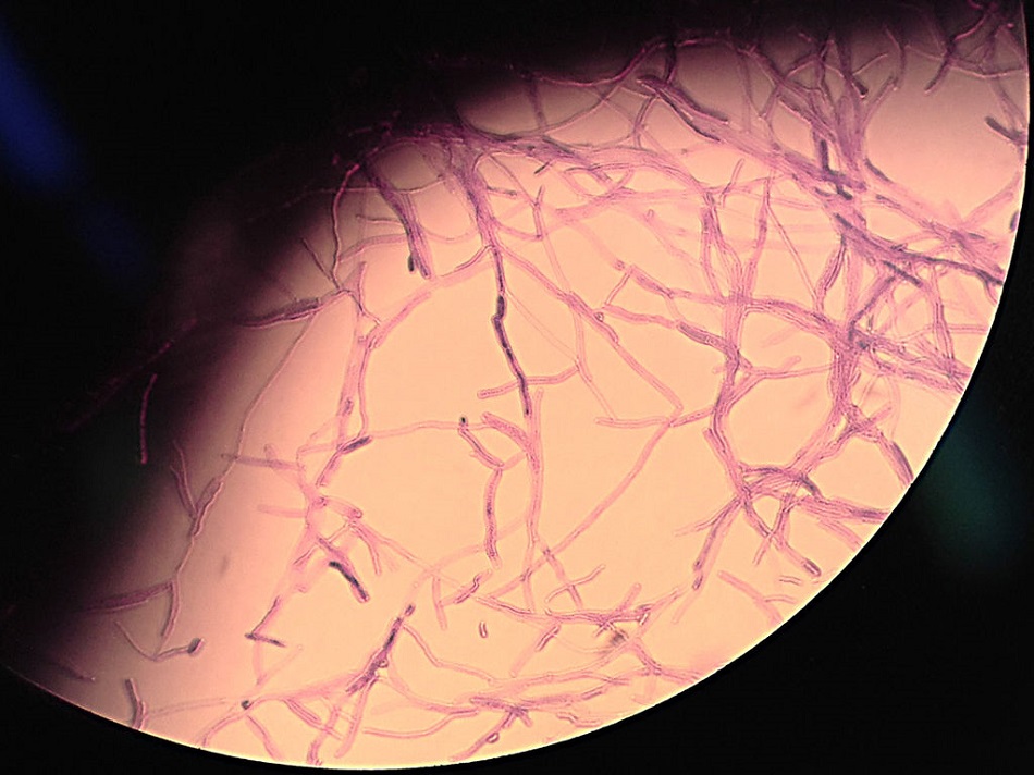 Mikroskopický snímek kvasinek Yarrowia lipolytica v 400 násobném zvětšení po obarvení methylenovou modří  (A doubt (Own work) [CC BY-SA 3.0 (http://creativecommons.org/licenses/by-sa/3.0)], via Wikimedia Commons).