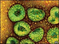 Takto vypadá virus nemoci SARS pod elektronovým mikroskopem (foto BBC).