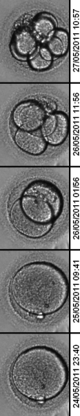 Zdola nahoru: Vývoj embrya od jednobuněčného stadia, přes vznik prvojader, až do stadia 8-buněčného