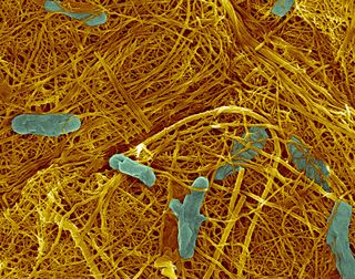 Bakterie Shewanella na pletivu nanotrubic ze sulfidu arsenitého (foto Hor-Gil Hur, GIST)