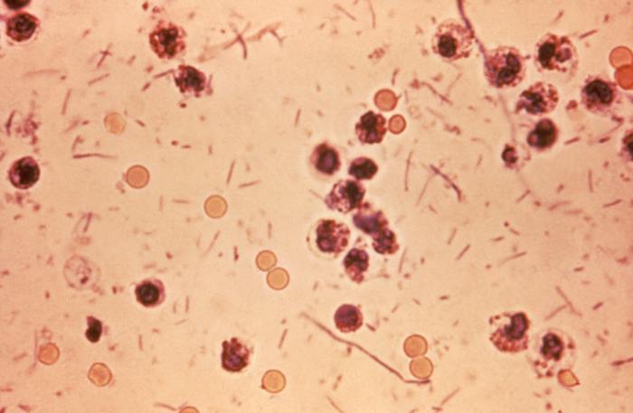 Mikroskopický snímek bakterií rodu Shigella ve stolici. Bakterie jsou ty čárky, kulaté útvary jsou tělní buňky, foto Centers for Disease Control and Prevention Publich Health Image Library [Public domain].