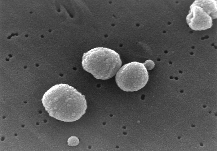 Bakterie Streptococcus pneumoniae na snímku rastrovacího elektronového mikroskopu, obr. Janice Carr/Centers for Disease Control.
