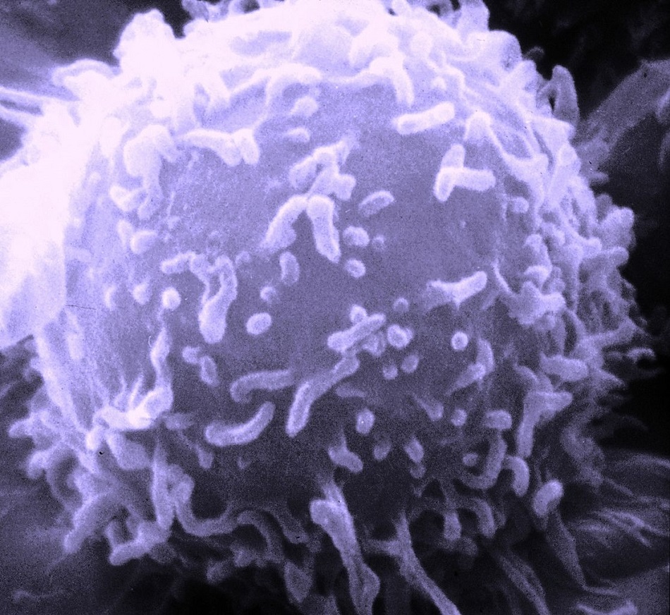 Lidský T lymfocyt na snímku elektronového mikroskopu, National Cancer Institute, public domain, via Wikimedia Commons.