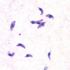 mikroskopický snímek aktivního stádia prvoka Toxoplasma gondii, barveno Giemsovým roztokem, délka prvoka 4-8 mikrometru, šířka 2-3 mikrometry, foto Centers for Disease Control & Prevention .