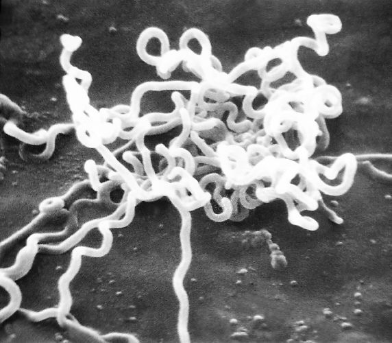Mikroskopický snímek bakterie Treponema pallidum, původce syfilidy (foto CDC/Dr. David Cox, licencováno jako volné dílo via Wikimedia Commons).