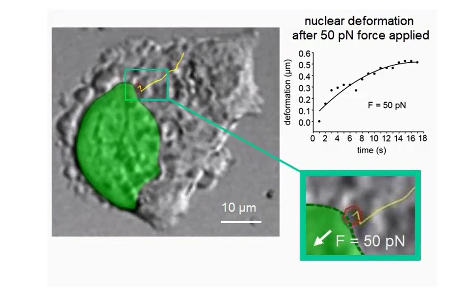 Mikroskopický snímek buňky rakoviny močového měchýře se žlutě vyznačenou cestou nanočástice, obr. Wang et al., Sci. Robot. 4, eaav6180, 2019.