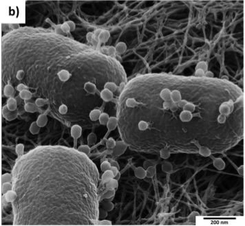 Kolonie bakterií E.coli napadené T4 bakteriofágem (M. Leppänen, L.-R. Sundberg, E. Laanto, G. M. de F. Almeida, P. Papponen, I. J. Maasilta, Adv. Biosys. 2017, https://doi.org/10.1002/adbi.201700070 ).
