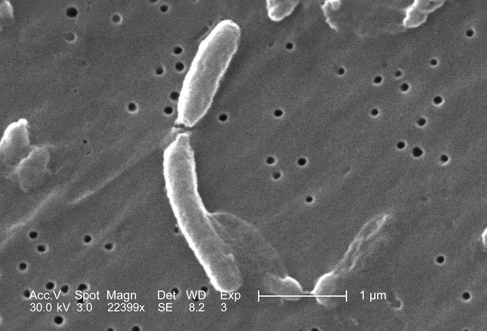 Bakterie Vibrio cholerae na snímku elektronového mikroskopu, foto Centers for Disease Control and Prevention, volné dílo.
