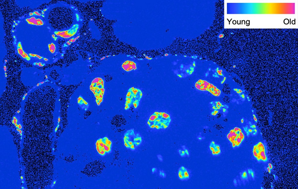 Mikroskopický snímek řezu tkání pankreatu s vyznačením stáří buněk podle značení radioaktivním dusíkem N15. Nejmladší jsou tmavě modré buňky, nejstarší fialové, obr.ze Salk Institute for Biological Studies.