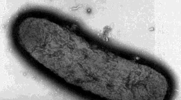 mikroskopický snímek bakterie Yersinia Pestis