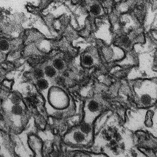 Snímek virionů Zika viru pořízený elektronovým mikroskopem (Centers for Disease Control and Prevention/Cynthia Goldsmith).